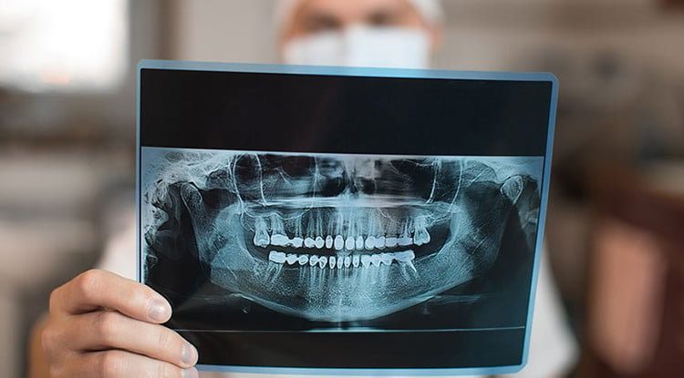 dental-radyoloji-klinik19-corum